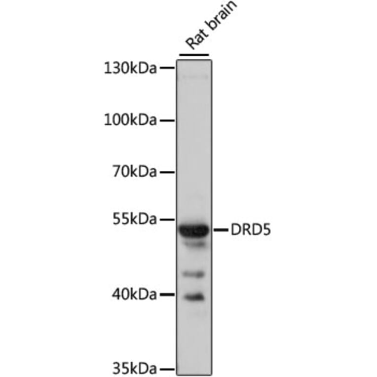 Western Blot - Anti-DRD5 Antibody (A3170) - Antibodies.com