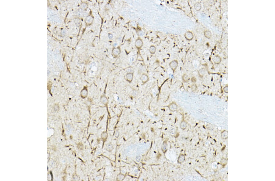 Immunohistochemistry - Anti-DUSP6 Antibody (A14387) - Antibodies.com