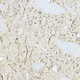 Immunohistochemistry - Anti-DUSP6 Antibody (A14387) - Antibodies.com