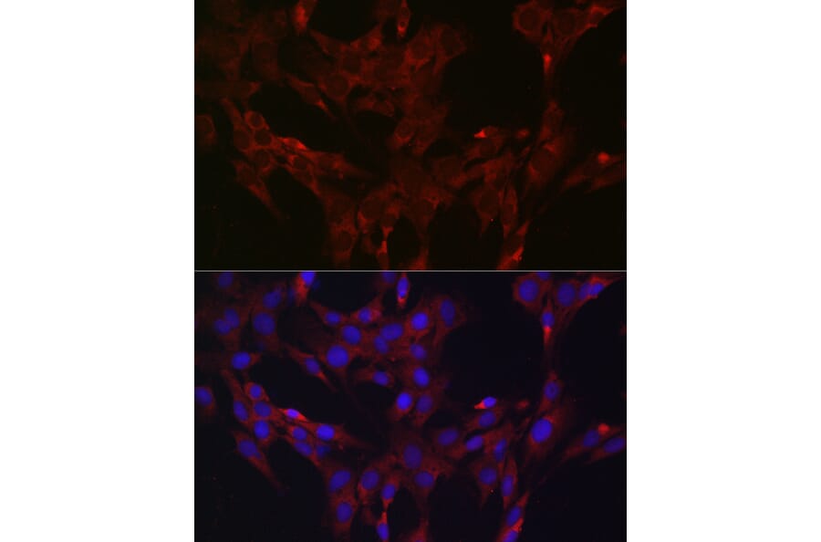 Immunofluorescence - Anti-DUSP6 Antibody (A14387) - Antibodies.com
