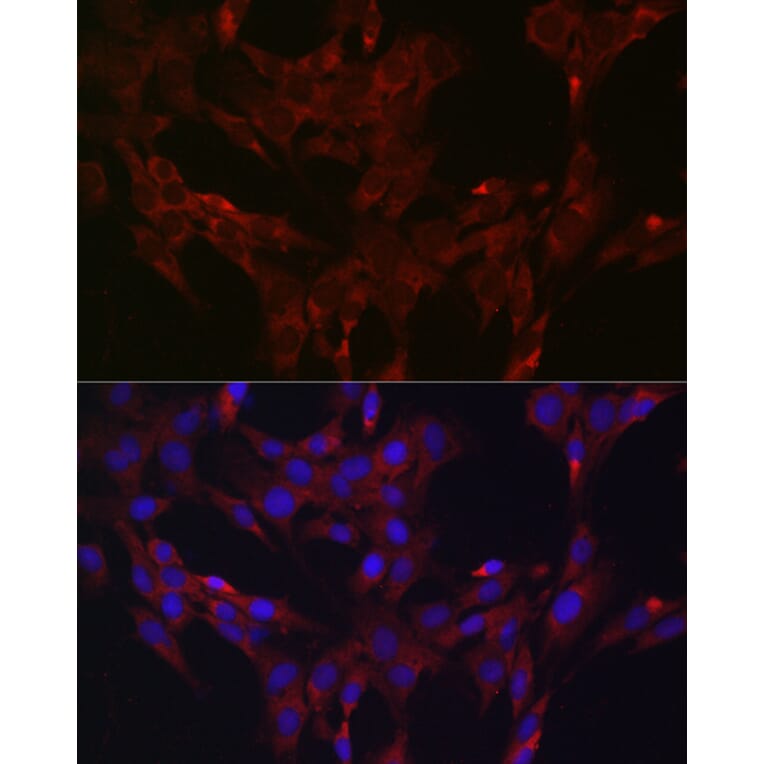 Immunofluorescence - Anti-DUSP6 Antibody (A14387) - Antibodies.com