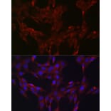 Immunofluorescence - Anti-DUSP6 Antibody (A14387) - Antibodies.com