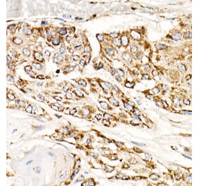 Western Blot - Anti-mtTFA Antibody [ARC51776] (A14389) - Antibodies.com