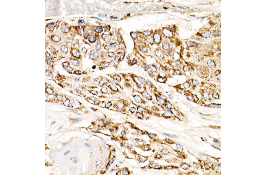 Western Blot - Anti-mtTFA Antibody [ARC51776] (A14389) - Antibodies.com