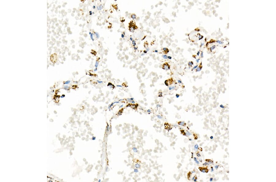 Immunohistochemistry - Anti-mtTFA Antibody [ARC51776] (A14389) - Antibodies.com