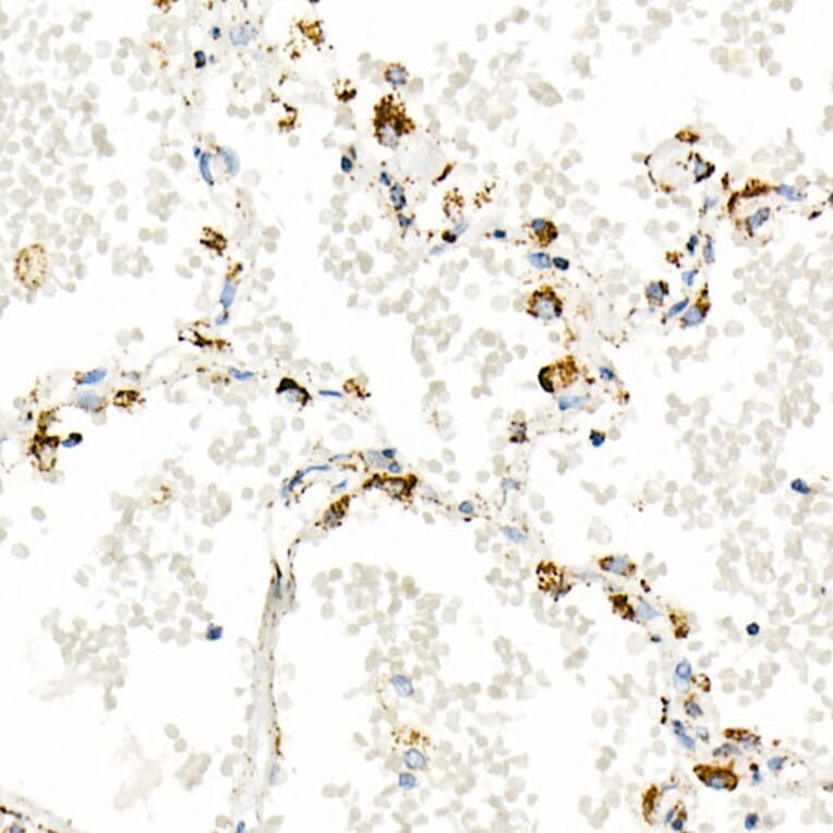 Immunohistochemistry - Anti-mtTFA Antibody [ARC51776] (A14389) - Antibodies.com