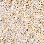 Immunohistochemistry - Anti-mtTFA Antibody [ARC51776] (A14389) - Antibodies.com