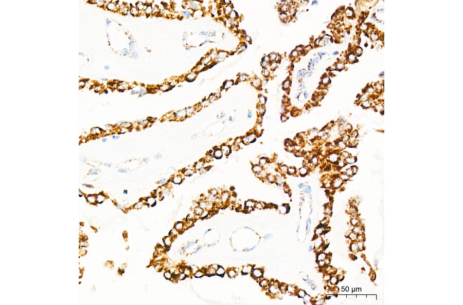 Immunohistochemistry - Anti-mtTFA Antibody (A14389) - Antibodies.com