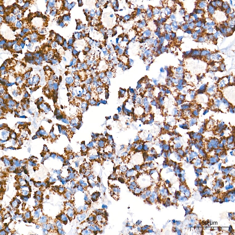 Immunofluorescence - Anti-mtTFA Antibody (A14389) - Antibodies.com