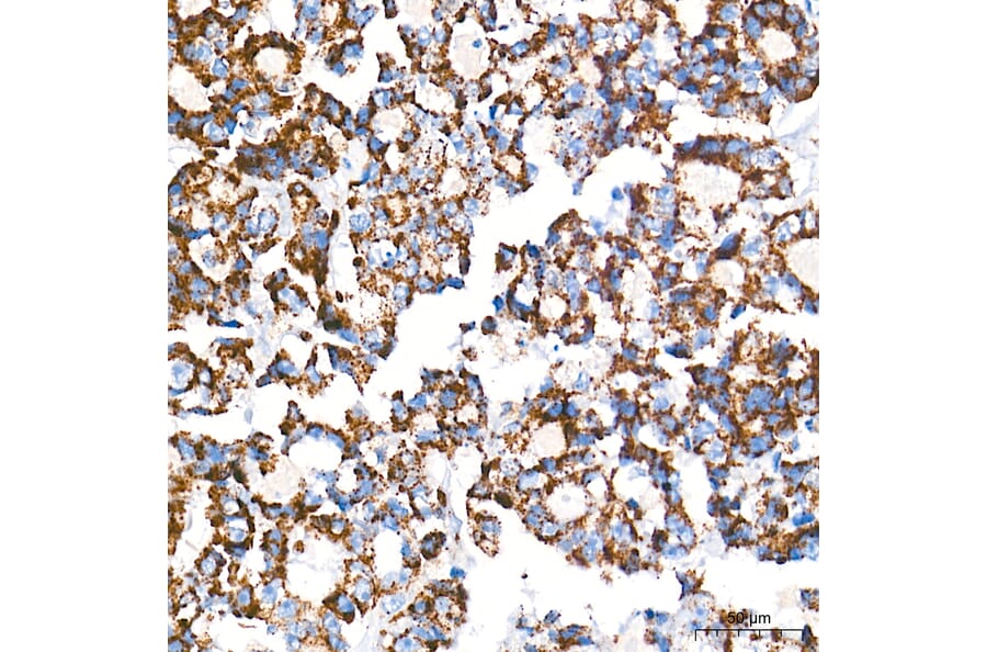 Chromatin Immunoprecipitation - Anti-mtTFA Antibody (A14389) - Antibodies.com