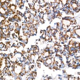 Chromatin Immunoprecipitation - Anti-mtTFA Antibody (A14389) - Antibodies.com