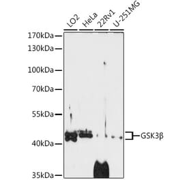 Western Blot - Anti-GSK3 beta Antibody (A14390) - Antibodies.com