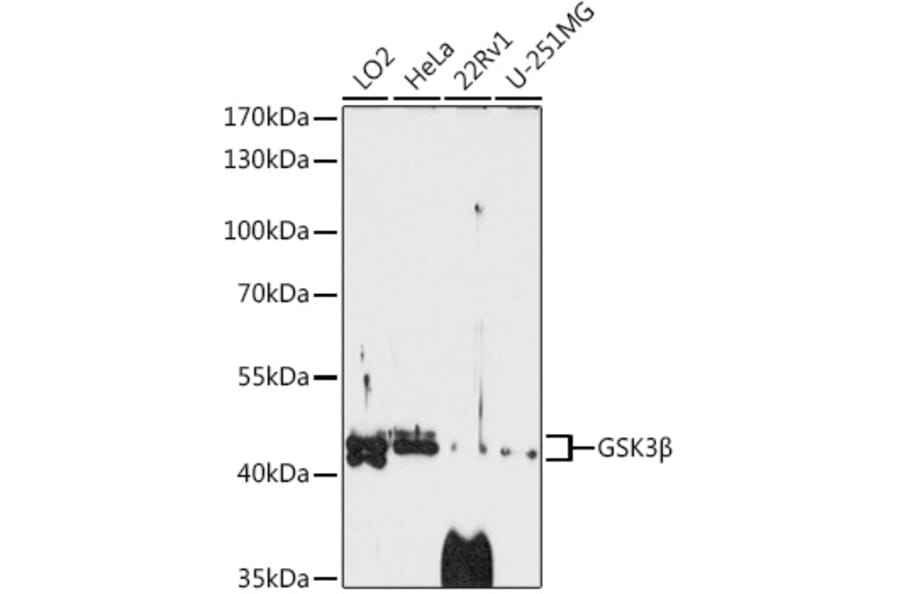 Western Blot - Anti-GSK3 beta Antibody (A14390) - Antibodies.com