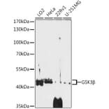 Western Blot - Anti-GSK3 beta Antibody (A14390) - Antibodies.com