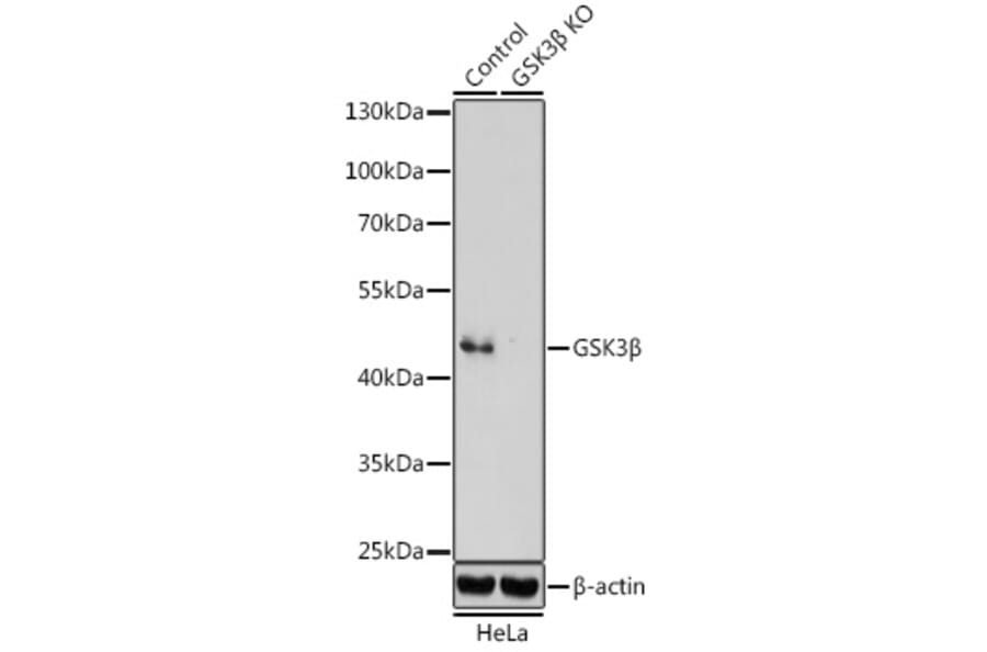 Western Blot - Anti-GSK3 beta Antibody (A14390) - Antibodies.com