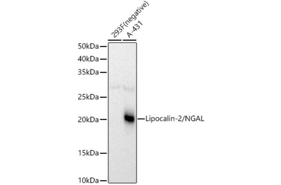 Western Blot - Anti-Lipocalin-2/NGAL Antibody (A14391) - Antibodies.com