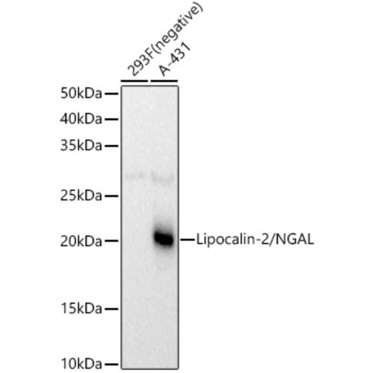 Western Blot - Anti-Lipocalin-2/NGAL Antibody (A14391) - Antibodies.com