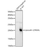 Western Blot - Anti-Lipocalin-2/NGAL Antibody (A14391) - Antibodies.com