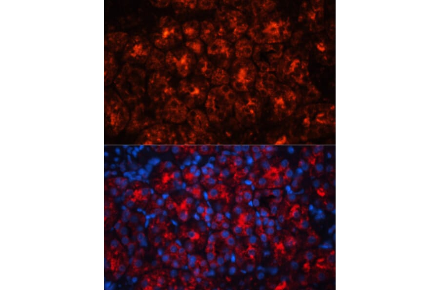 Immunofluorescence - Anti-Lipocalin-2/NGAL Antibody (A14391) - Antibodies.com