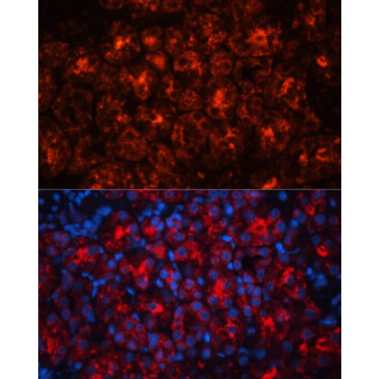 Immunofluorescence - Anti-Lipocalin-2/NGAL Antibody (A14391) - Antibodies.com