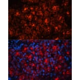 Immunofluorescence - Anti-Lipocalin-2/NGAL Antibody (A14391) - Antibodies.com