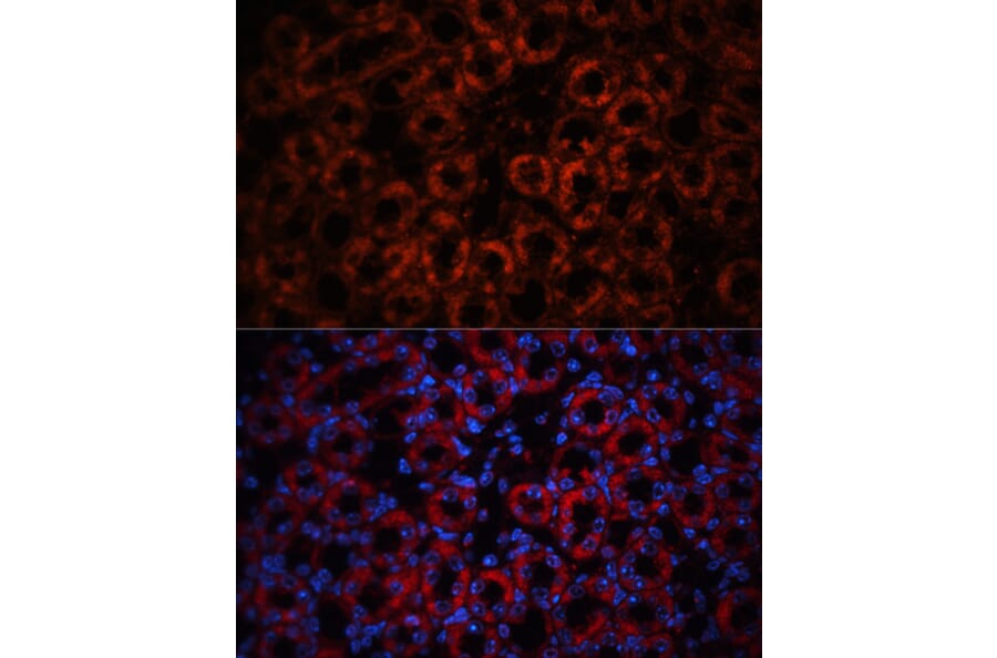 Immunofluorescence - Anti-Lipocalin-2/NGAL Antibody (A14391) - Antibodies.com