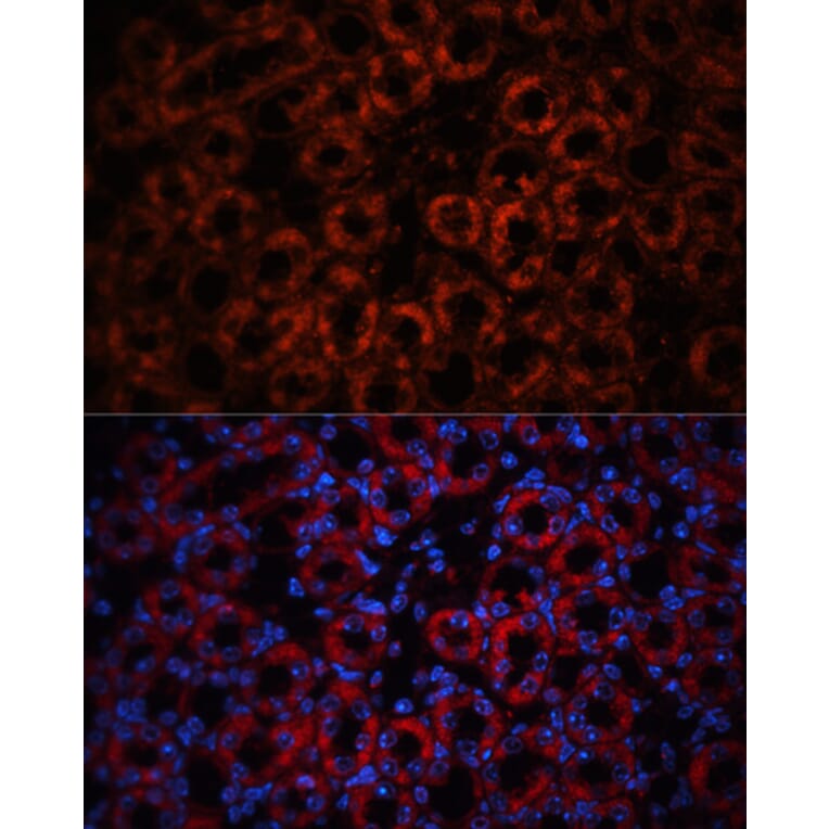 Immunofluorescence - Anti-Lipocalin-2/NGAL Antibody (A14391) - Antibodies.com