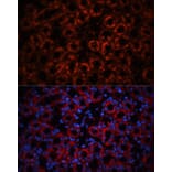 Immunofluorescence - Anti-Lipocalin-2/NGAL Antibody (A14391) - Antibodies.com