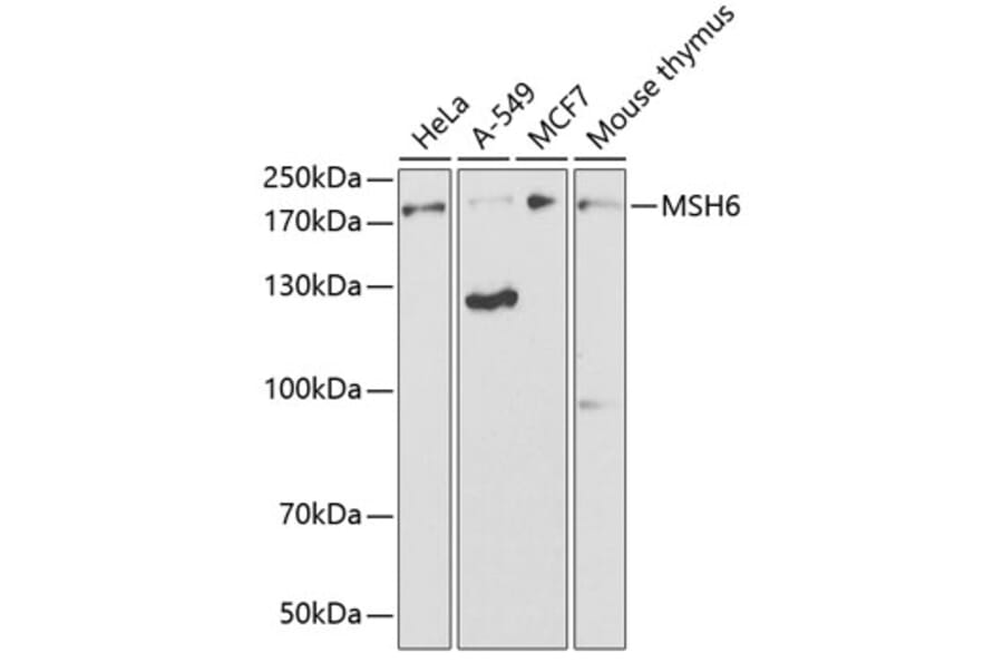 Western Blot - Anti-MSH6 Antibody (A14392) - Antibodies.com