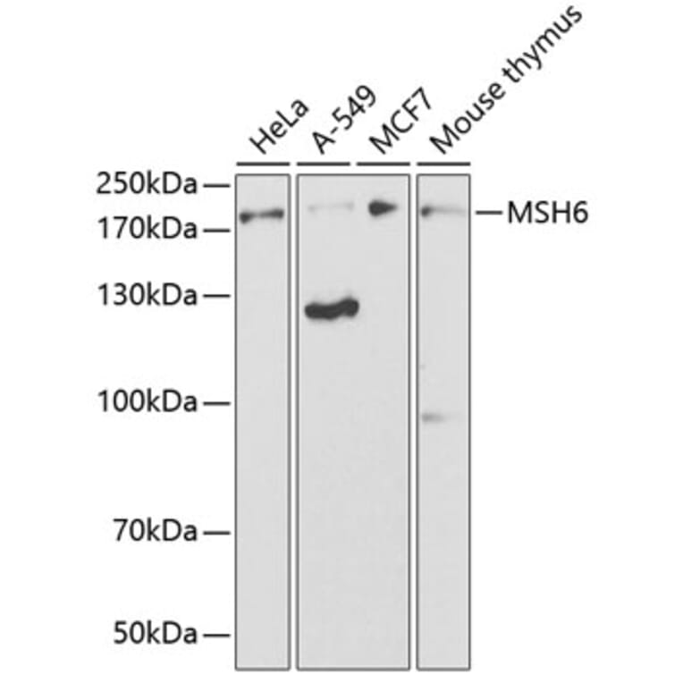 Western Blot - Anti-MSH6 Antibody (A14392) - Antibodies.com