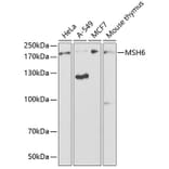 Western Blot - Anti-MSH6 Antibody (A14392) - Antibodies.com