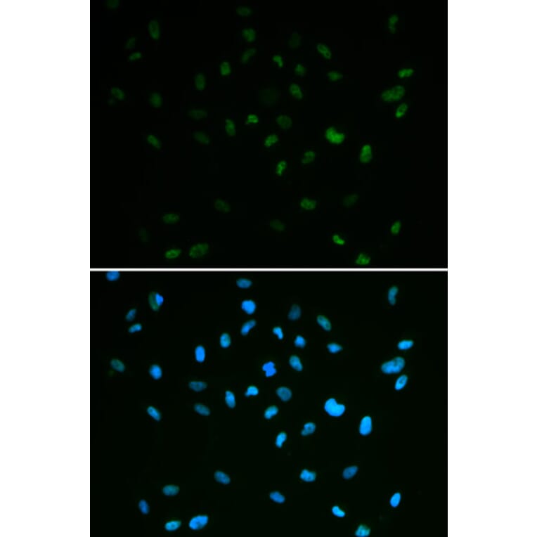 Immunofluorescence - Anti-MSH6 Antibody (A14392) - Antibodies.com