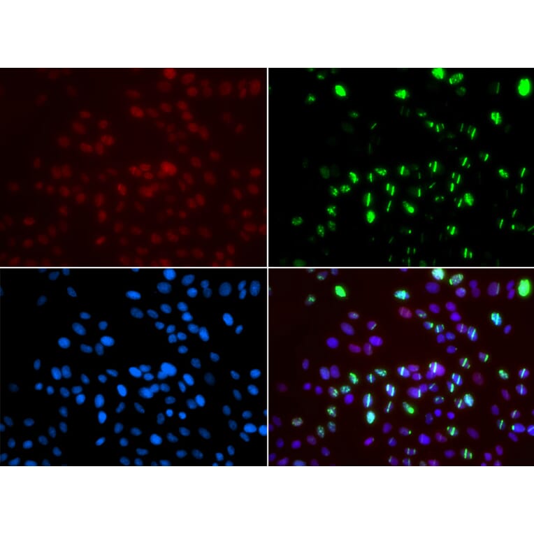 Immunofluorescence - Anti-MSH6 Antibody (A14392) - Antibodies.com