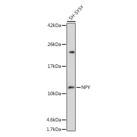 Western Blot - Anti-Neuropeptide Y Antibody (A14393) - Antibodies.com