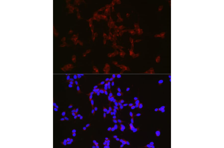 Immunofluorescence - Anti-Neuropeptide Y Antibody (A14393) - Antibodies.com