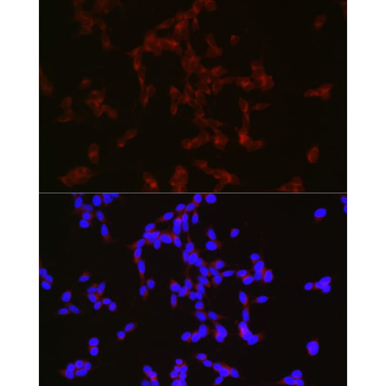 Immunofluorescence - Anti-Neuropeptide Y Antibody (A14393) - Antibodies.com