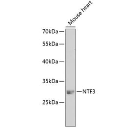 Western Blot - Anti-Neurotrophin 3 Antibody (A14394) - Antibodies.com