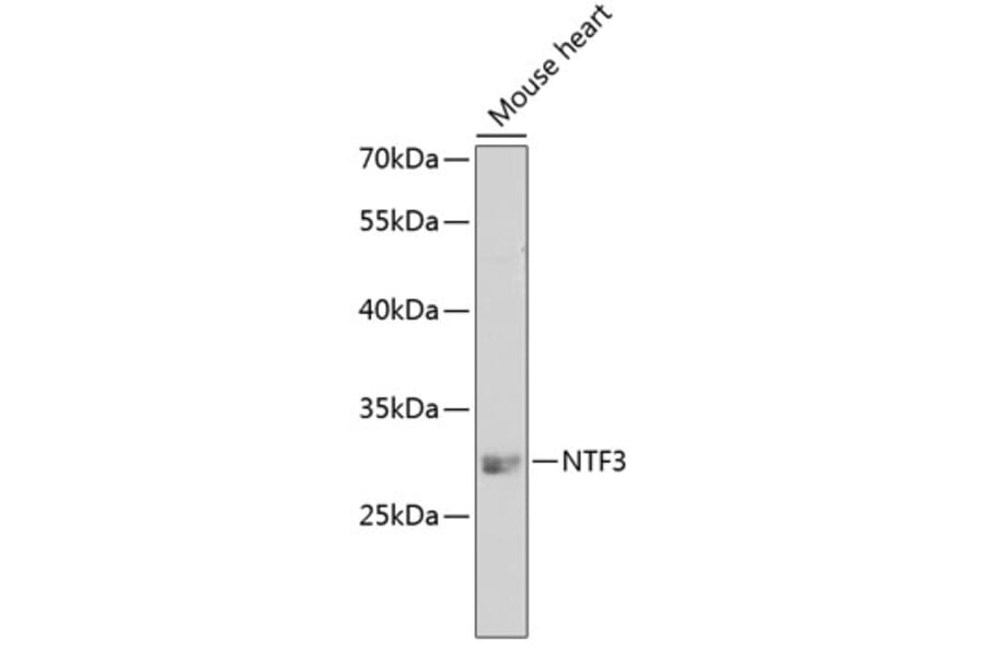 Western Blot - Anti-Neurotrophin 3 Antibody (A14394) - Antibodies.com