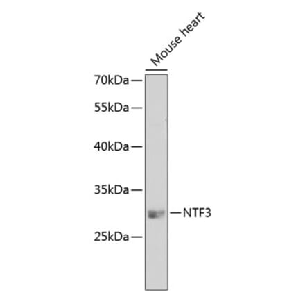 Western Blot - Anti-Neurotrophin 3 Antibody (A14394) - Antibodies.com