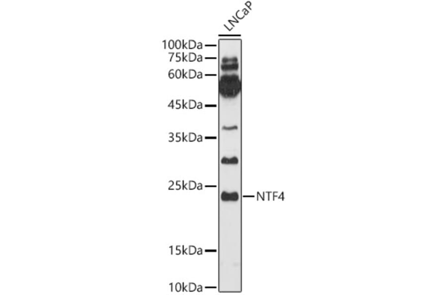 Western Blot - Anti-NT-4 Antibody (A14395) - Antibodies.com