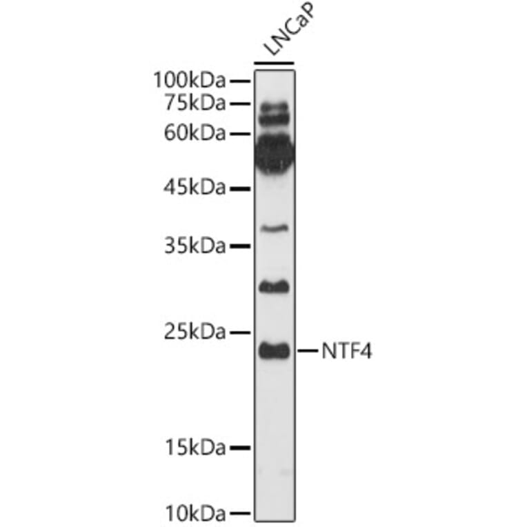 Western Blot - Anti-NT-4 Antibody (A14395) - Antibodies.com