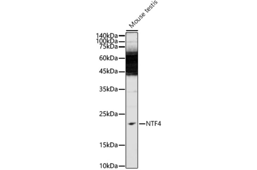 Western Blot - Anti-NT-4 Antibody (A14395) - Antibodies.com