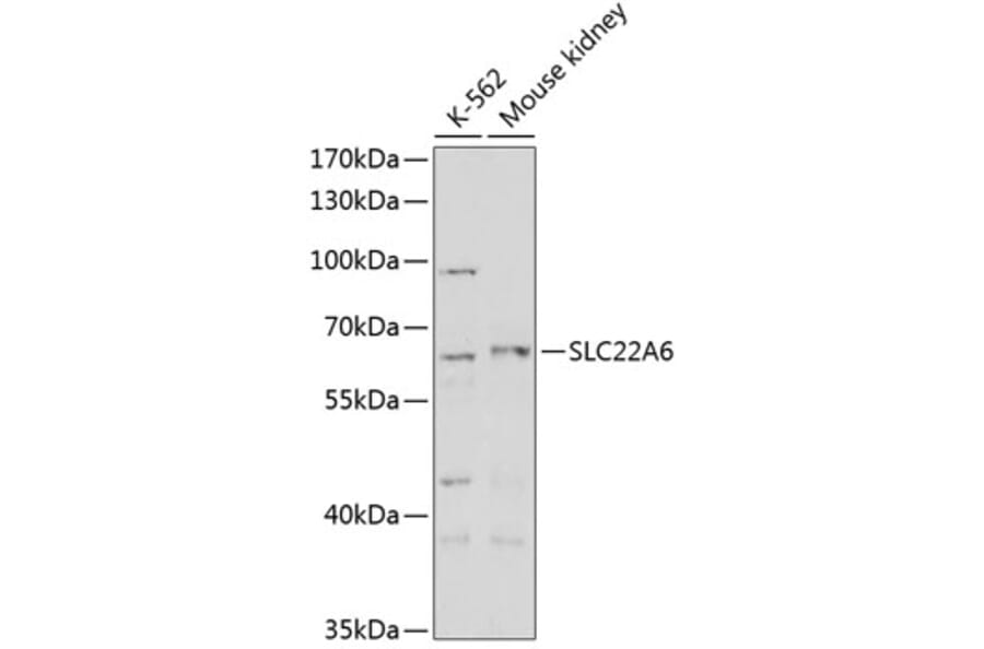 Western Blot - Anti-SLC22A6 Antibody (A14396) - Antibodies.com