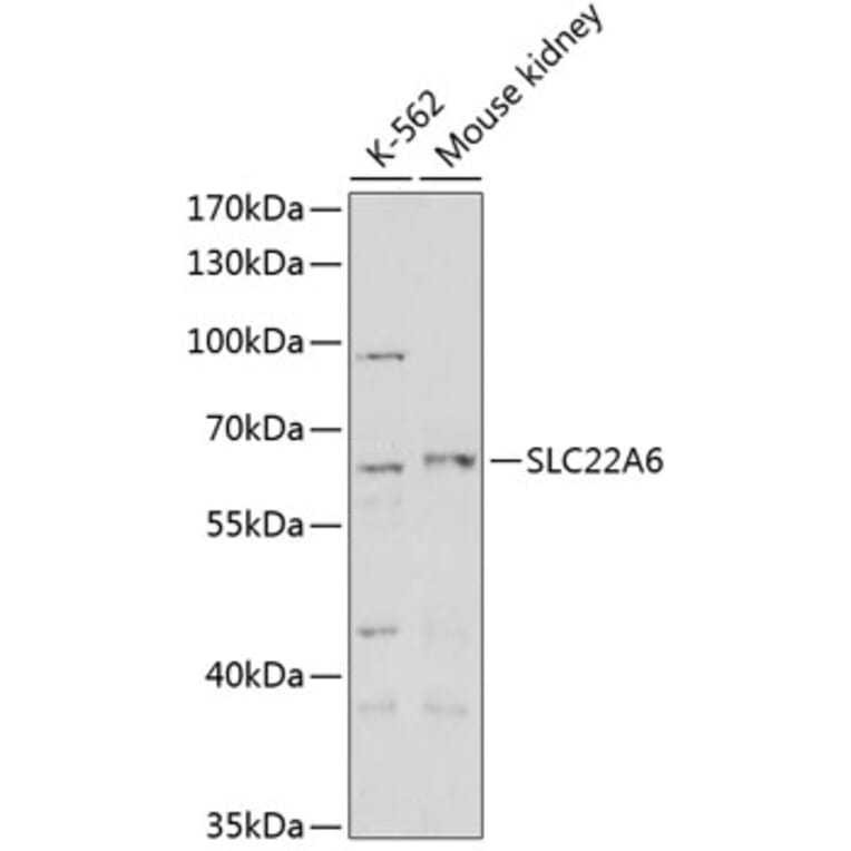 Western Blot - Anti-SLC22A6 Antibody (A14396) - Antibodies.com