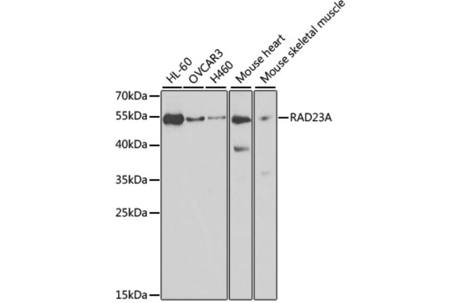 Western Blot - Anti-RAD23A Antibody (A3188) - Antibodies.com