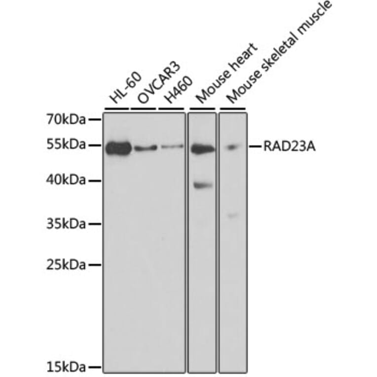 Western Blot - Anti-RAD23A Antibody (A3188) - Antibodies.com