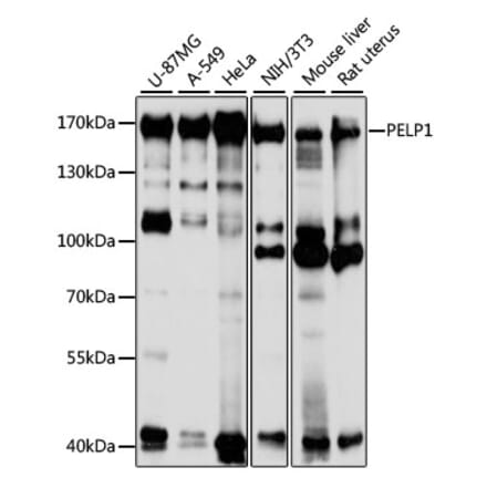 Western Blot - Anti-PELP1 Antibody (A14400) - Antibodies.com