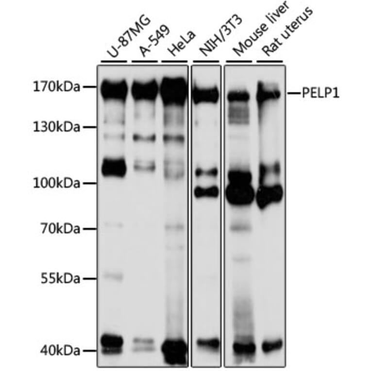 Western Blot - Anti-PELP1 Antibody (A14400) - Antibodies.com