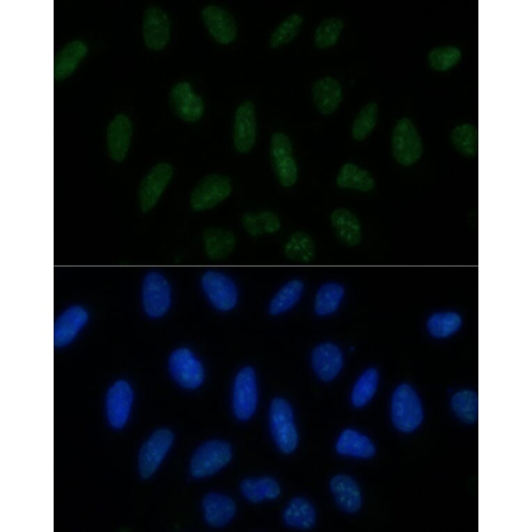 Immunofluorescence - Anti-PELP1 Antibody (A14400) - Antibodies.com