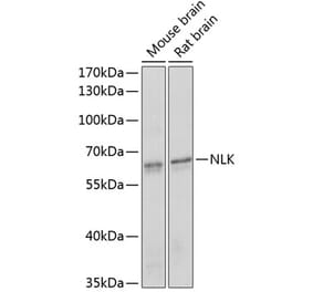 Western Blot - Anti-NLK Antibody (A14401) - Antibodies.com